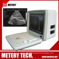 Portable digital ultrasound diagnostic system MT300V